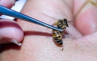 Bienengift: Nutzen und Schaden, was mit einem Bienenstich zu Hause zu tun ist