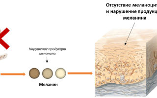 Welche Lebensmittel enthalten hohe Mengen an Melanin