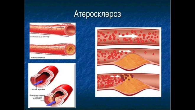 препоръки за използване на кардиомагнил