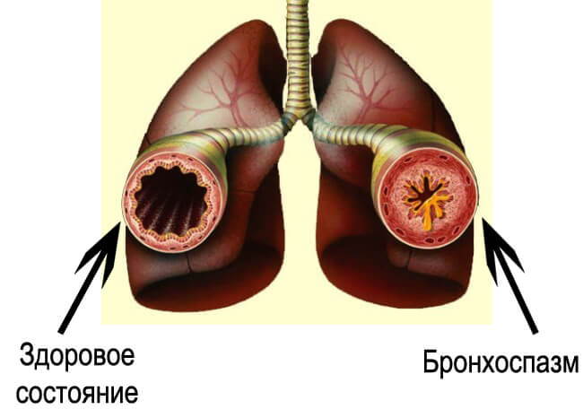 кардиомагнит - странични ефекти и противопоказания